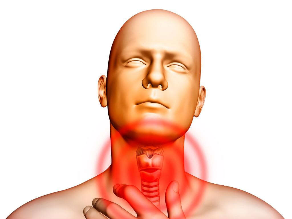 Gastroesophageal Reflux Disease