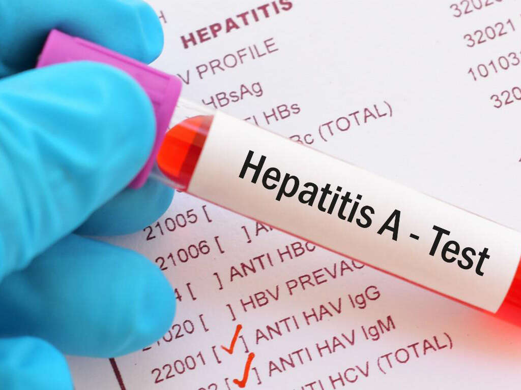 Hepatitis A