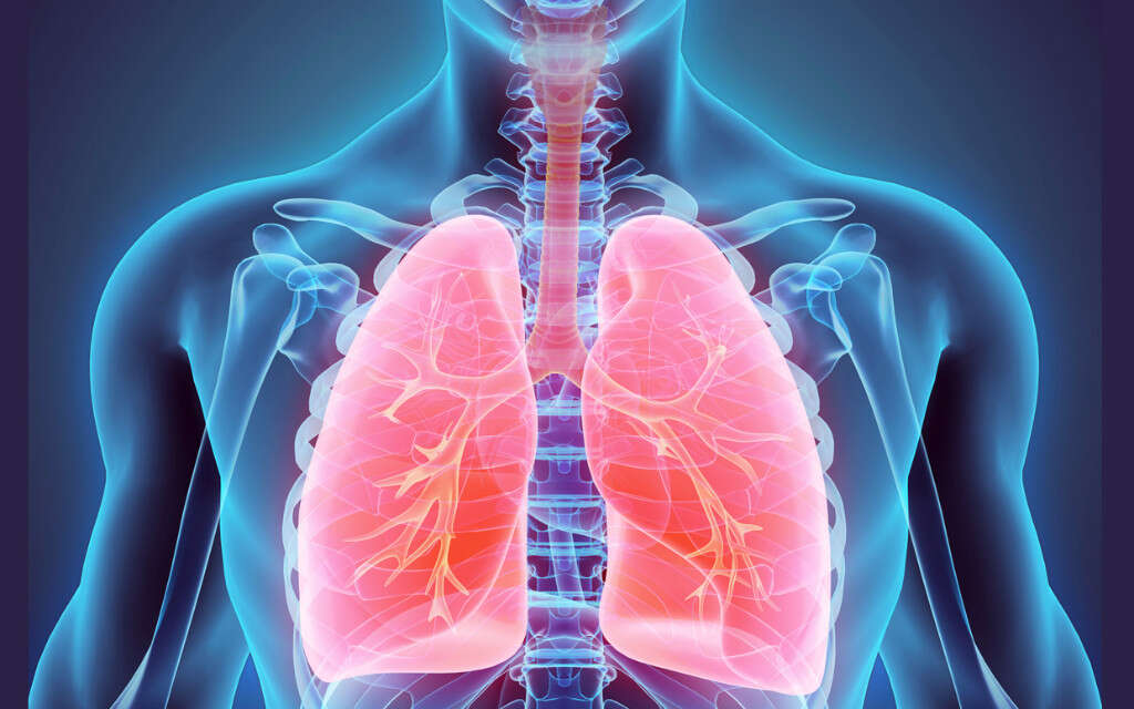 Pleural Effusion