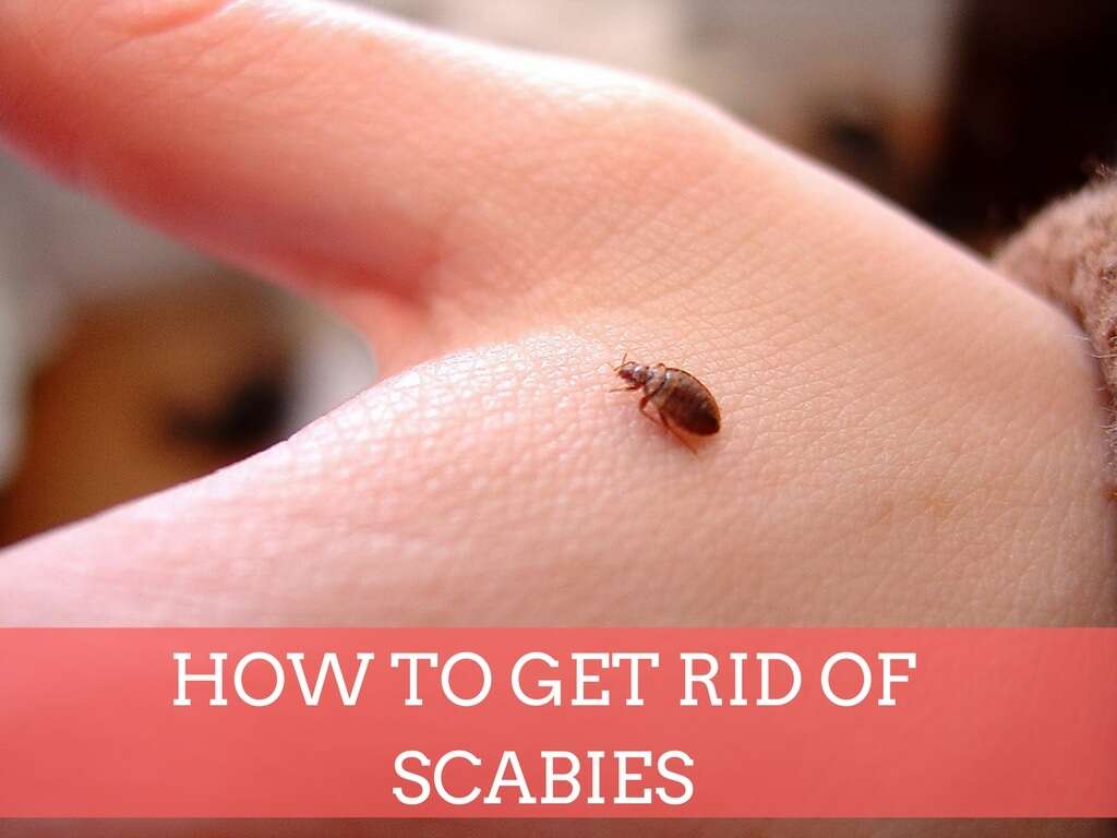 Scabies