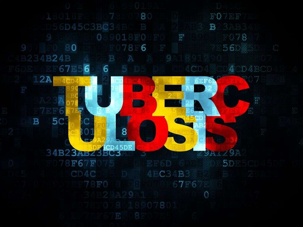 Tuberculosis