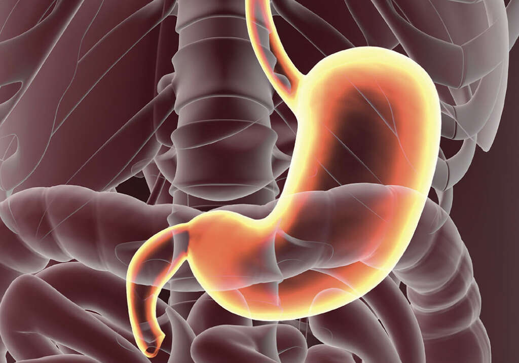 Gastrointestinal Disease