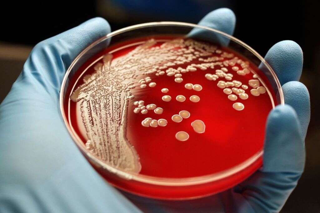 MRSA Infection