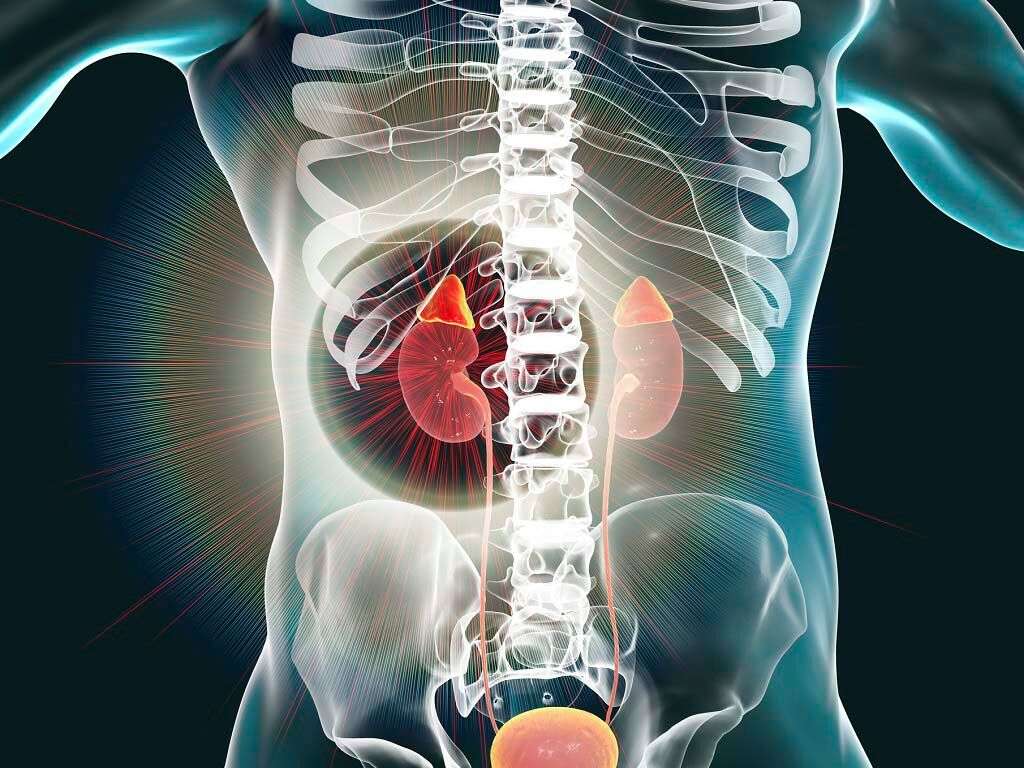 Addison's Disease