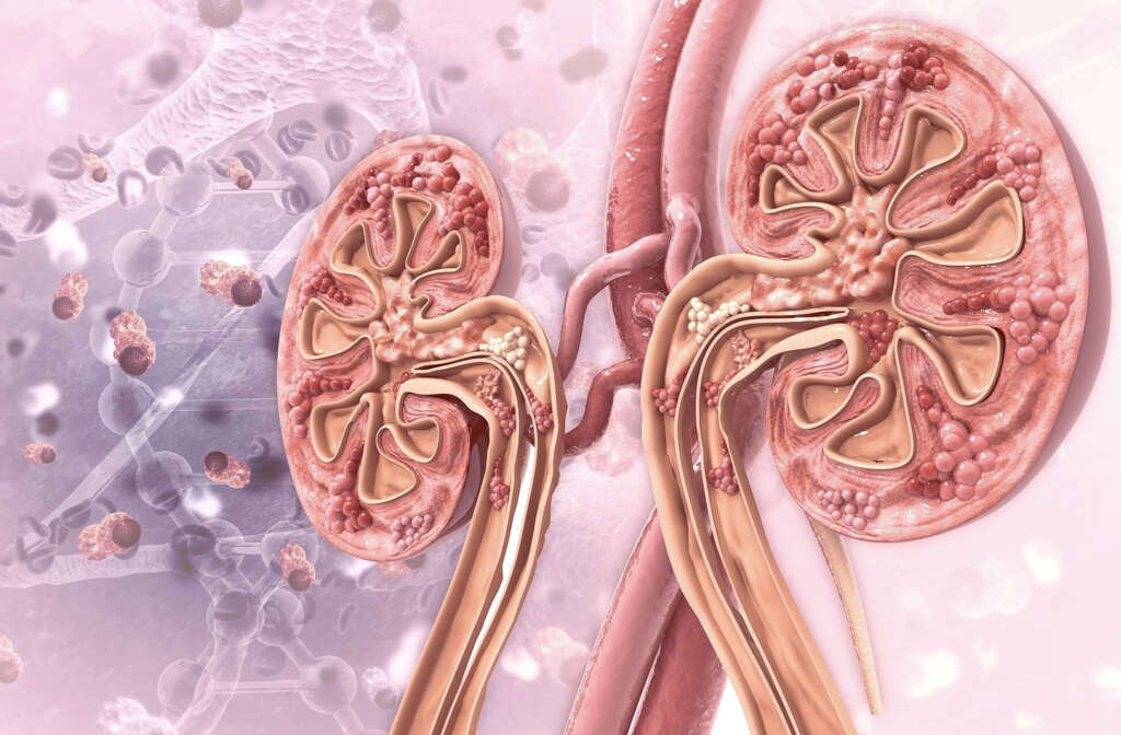 Anaplasmosis