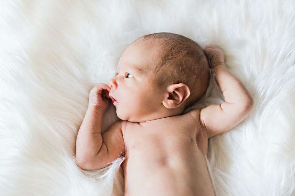 Cradle Cap