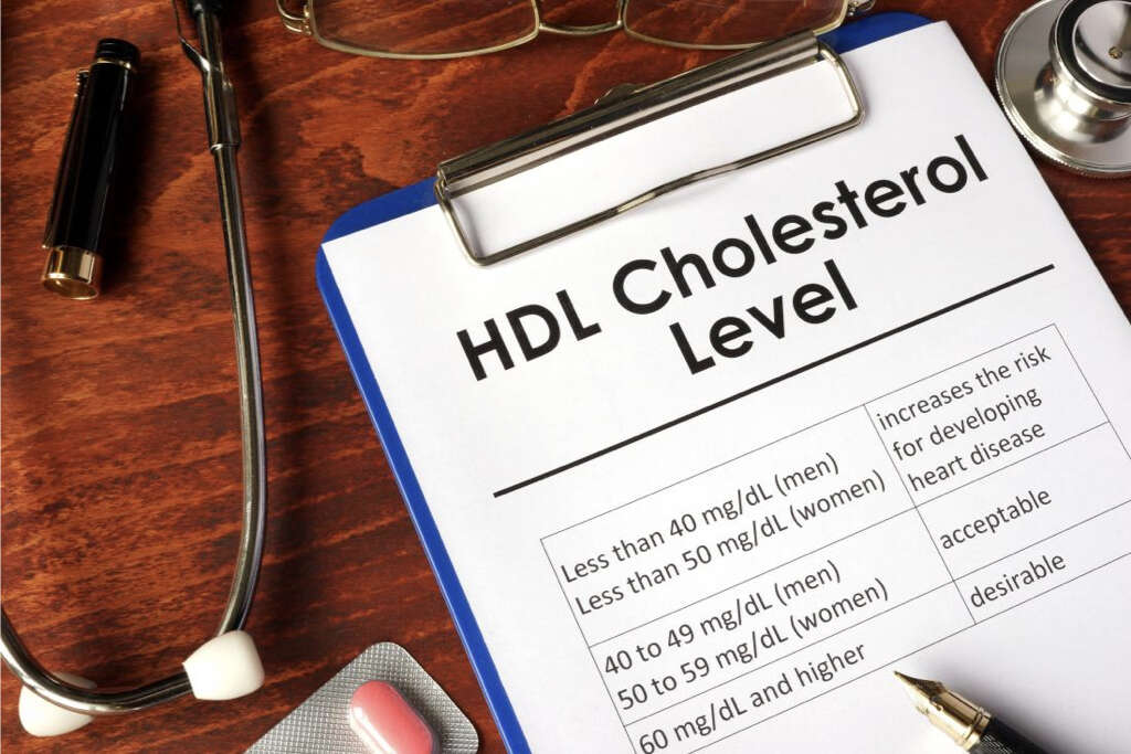 HDL Cholesterol