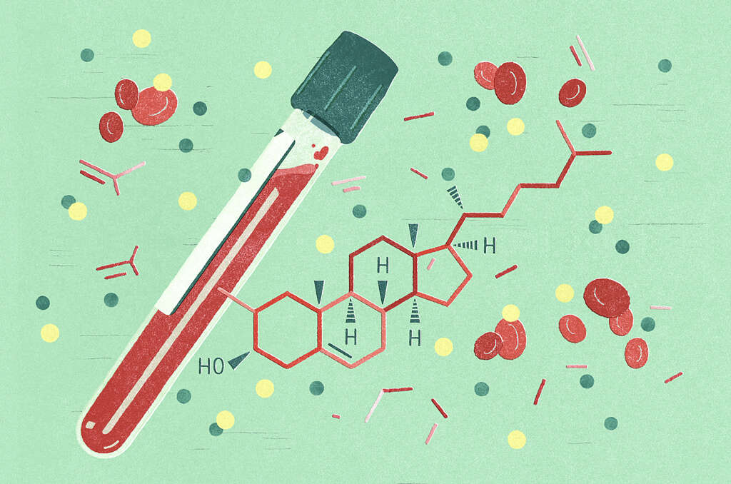 HDL Cholesterol