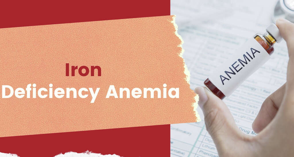 Iron Deficiency Anemia