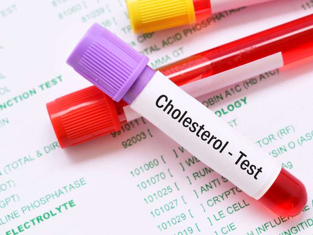 Oxidized Cholesterol