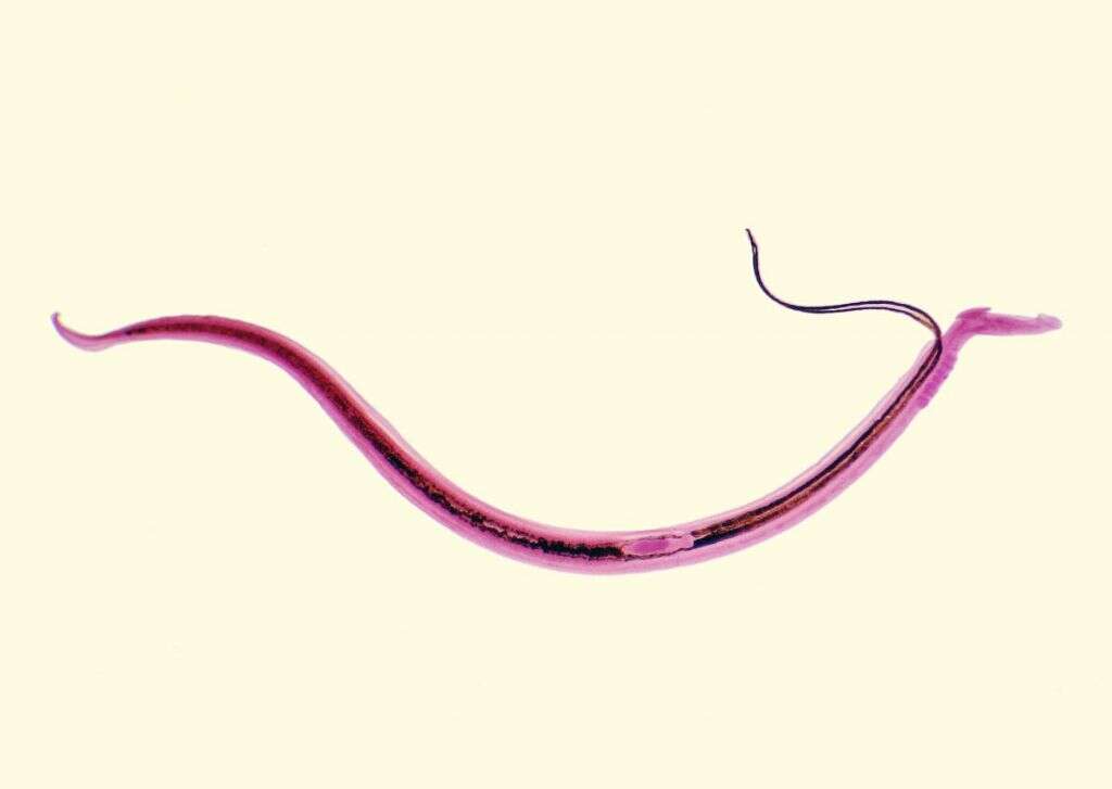 Schistosomiasis