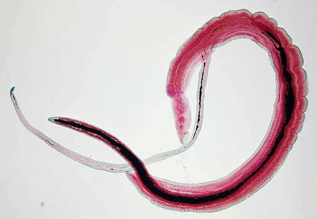 Schistosomiasis