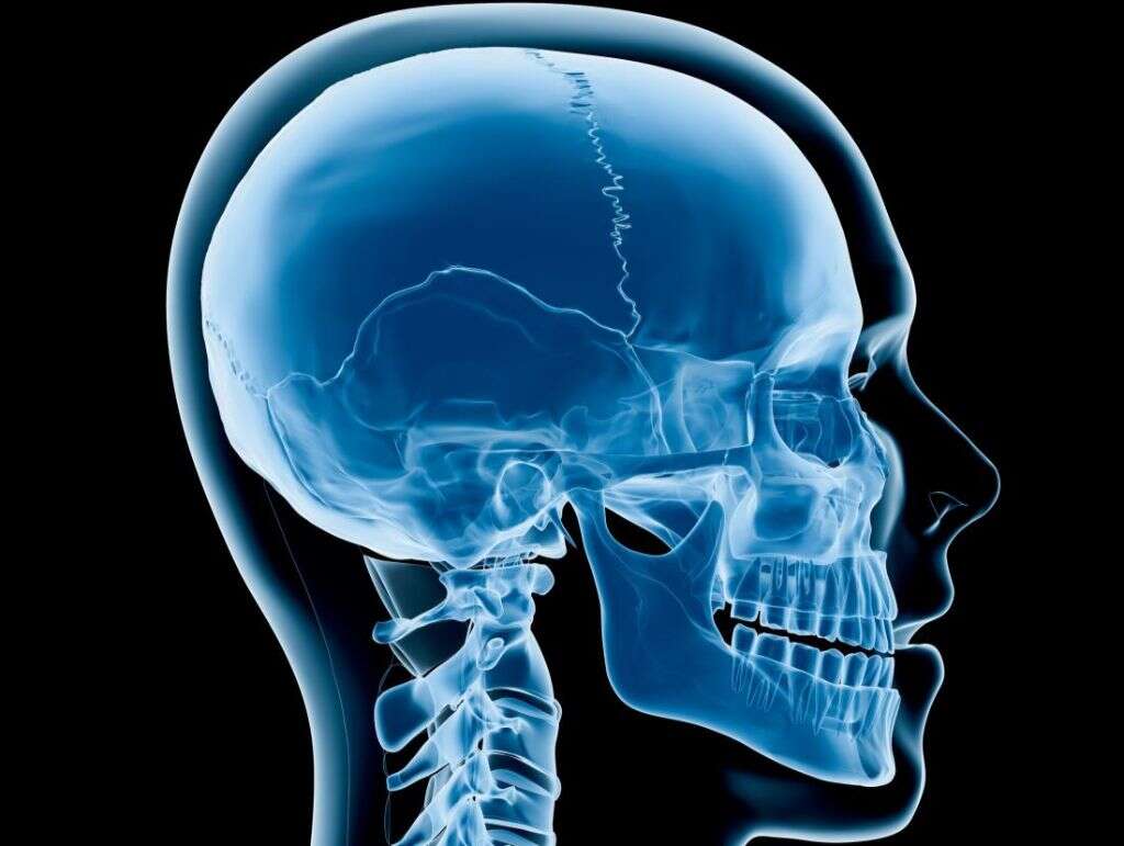 Stromme Syndrome