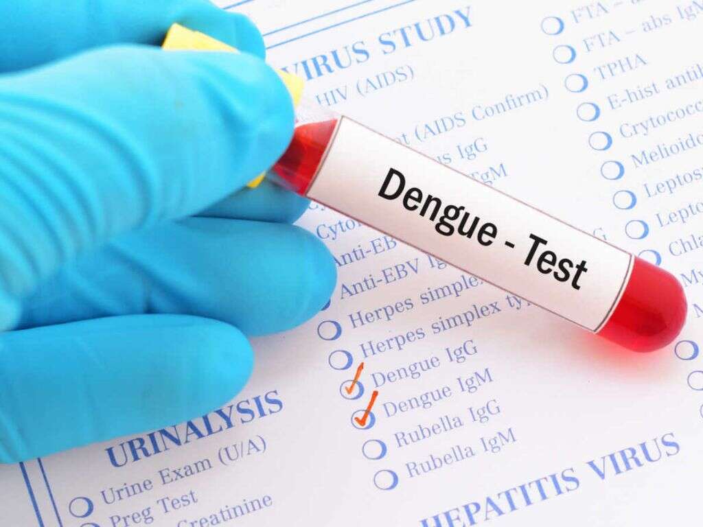 Dengue Virus