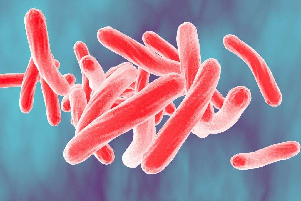 Tuberculosis